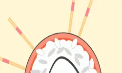 PinPoint image